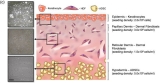 Forscher haben tiefe Wunden mit 3D-Biodruck erfolgreich geheilt